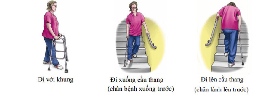 Phục hồi chức năng sau phẫu thuật thay khớp háng - bệnh viện Việt Đức