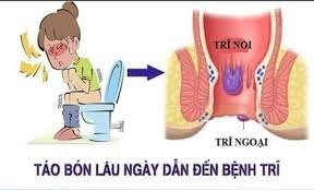 Thuốc trị táo bón