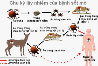 Tìm hiểu về bệnh Sốt Q - Bệnh viện Hoàn Mỹ Sài Gòn