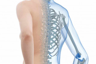 Tìm Hiểu Về Cách Phòng Ngừa Bệnh Loãng Xương - Bệnh viện Hoàn Mỹ Sài Gòn