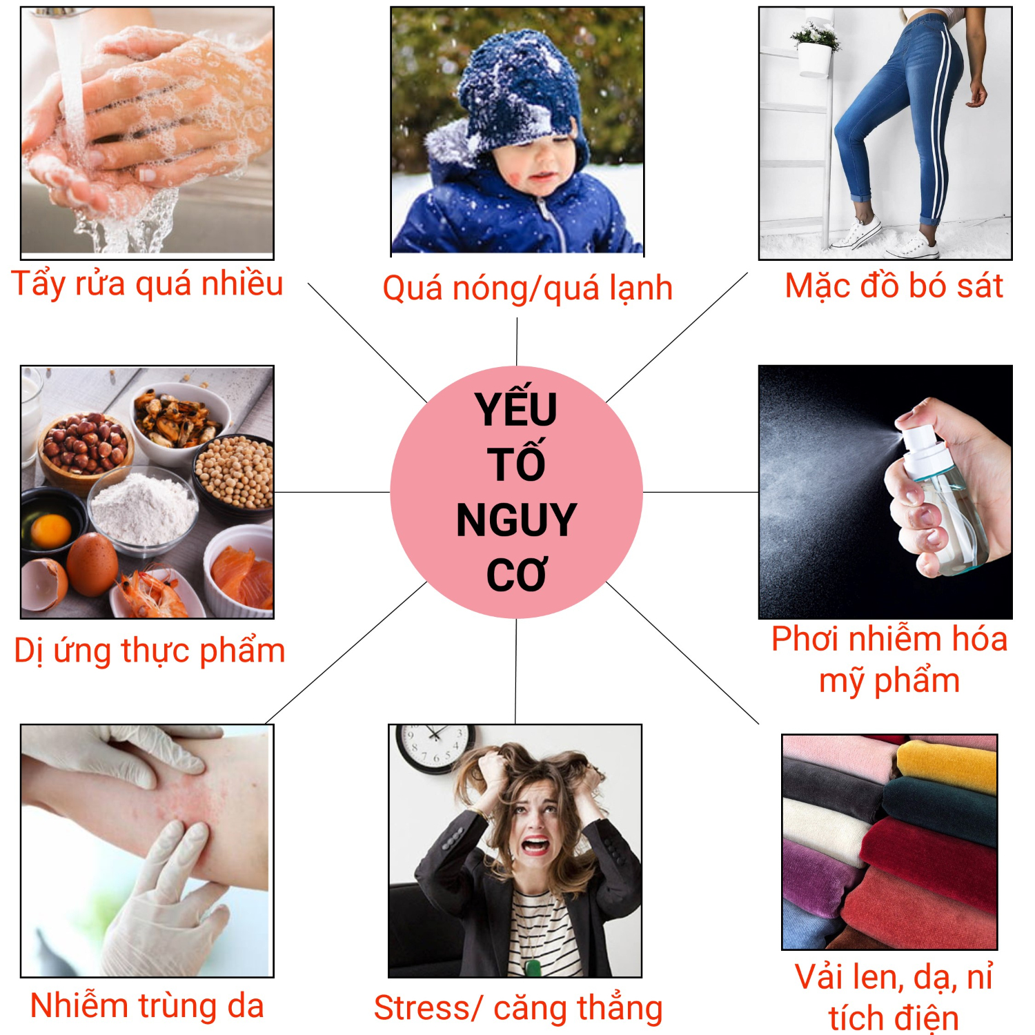 Những yếu tố nguy cơ làm tăng nặng bệnh viêm da cơ địa