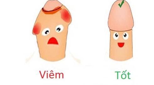 Viêm bao quy đầu vì dương vật bị cọ sát nhiều - Nam khoa Penuma