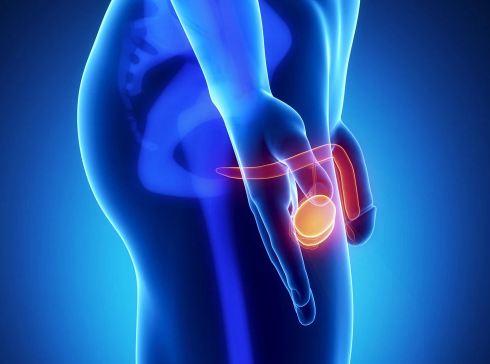 Ung thư dương vật, tuyệt đối không được chủ quan - Nam khoa Penuma