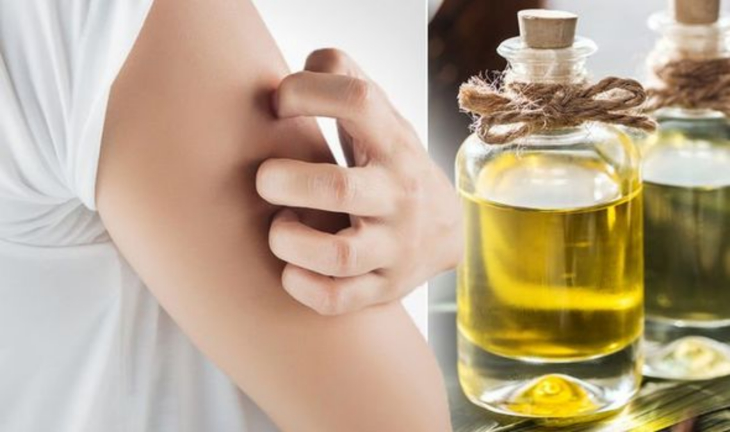 Có nên dùng dầu ô liu để trị viêm da cơ địa không?