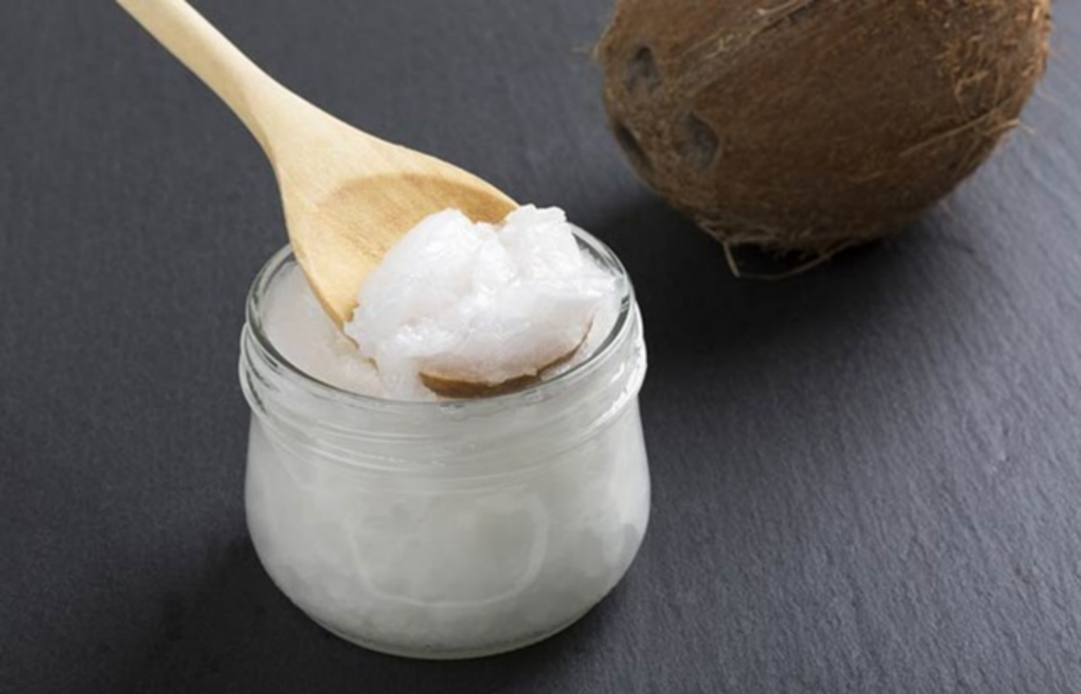 Dầu dừa có tác dụng điều trị vảy nến da đầu không?