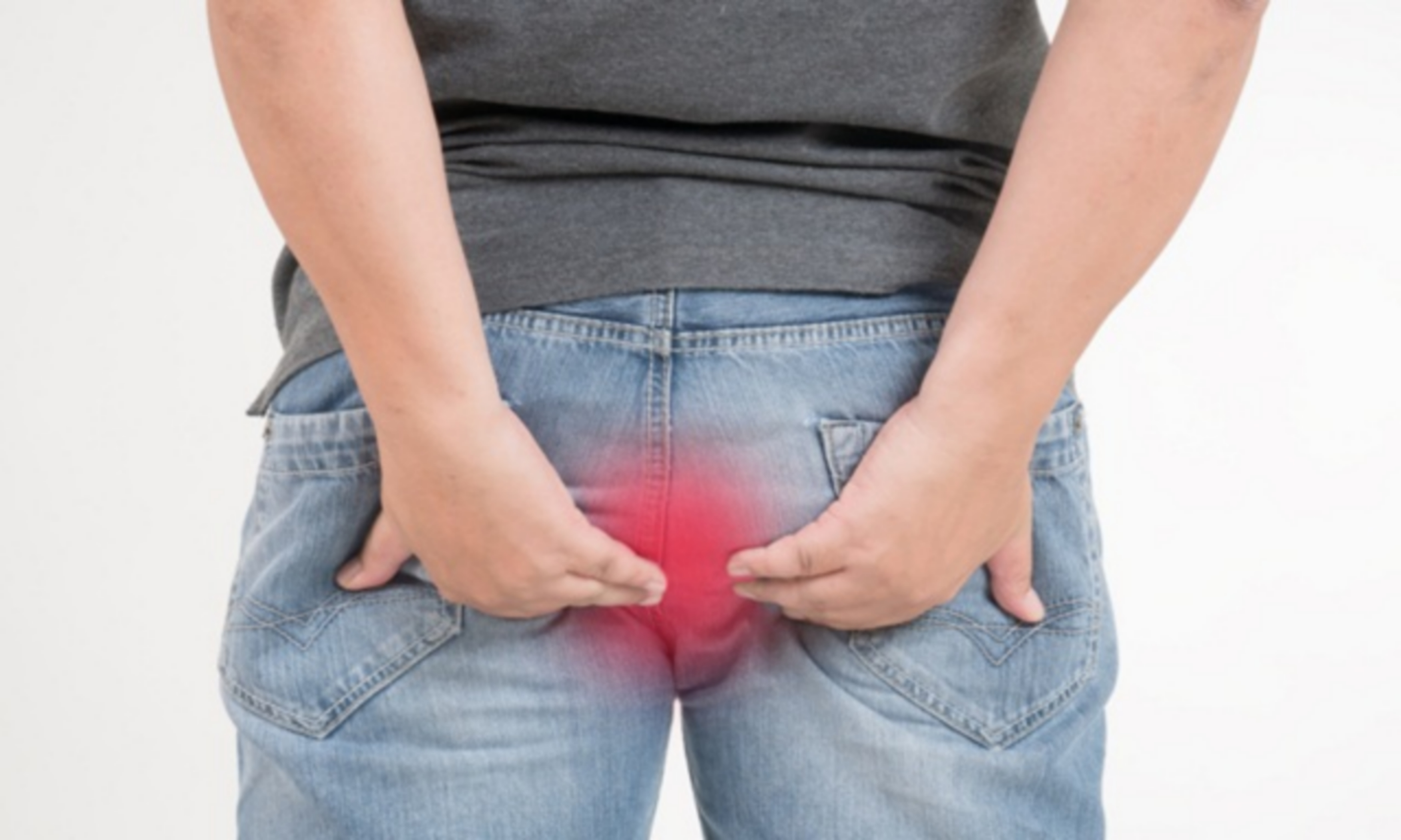 Bệnh trĩ điều trị bằng cách nào và bao lâu thì khỏi?
