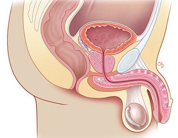Phẫu thuật cắt tuyến tiền liệt đơn giản