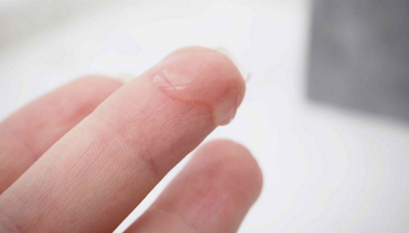 Biện pháp điều trị