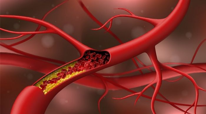 Cholesterol Là Gì? Những Lưu Ý Bạn Cần Biết