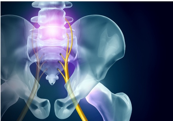 HIệu quả của kích thích điện thần kinh trong điều trị bàng quang tăng hoạt