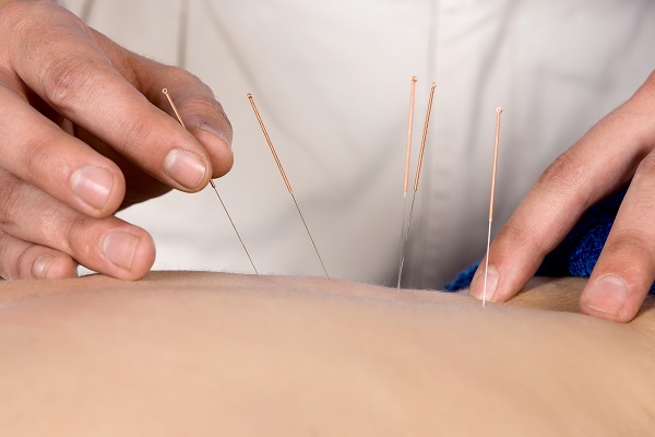 Các phương pháp điều trị thay thế cho hội chứng bàng quang tăng hoạt