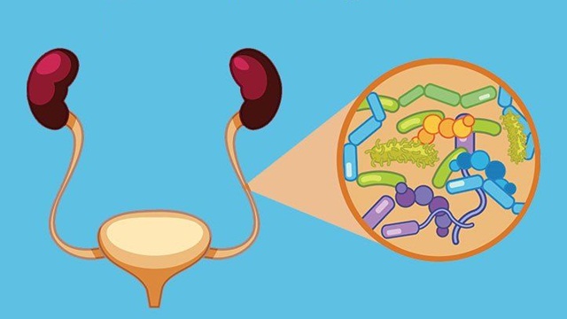 Các cách điều trị và phòng ngừa nhiễm trùng bàng quang