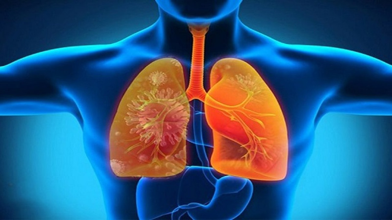 phân biệt viêm phổi và viêm phế quản