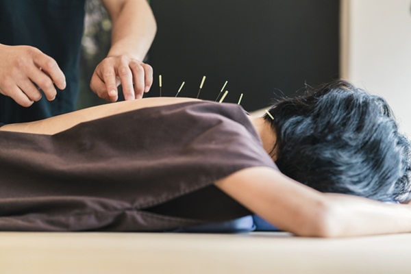 Điều trị loãng xương bằng thảo dược và châm cứu