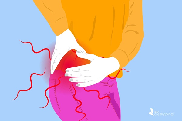 Các triệu chứng của viêm khớp dạng thấp ở hông