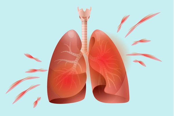 Ảnh hưởng của bệnh viêm khớp dạng thấp đến phổi