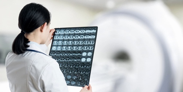 Đột quỵ được chẩn đoán bằng cách nào?