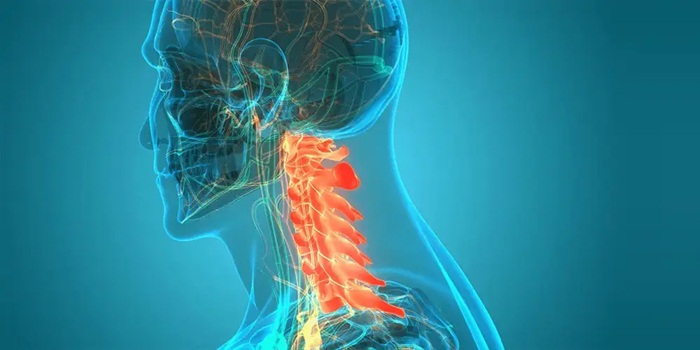 Đột quỵ tủy sống có tiên lượng ra sao?