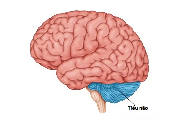 Đột quỵ tiểu não: Triệu chứng, cách điều trị và tiên lượng