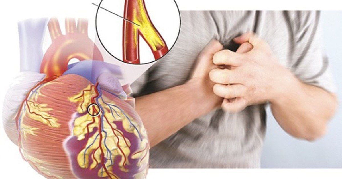 Làm thế nào để phân biệt đau thắt ngực và cơn đau tim?