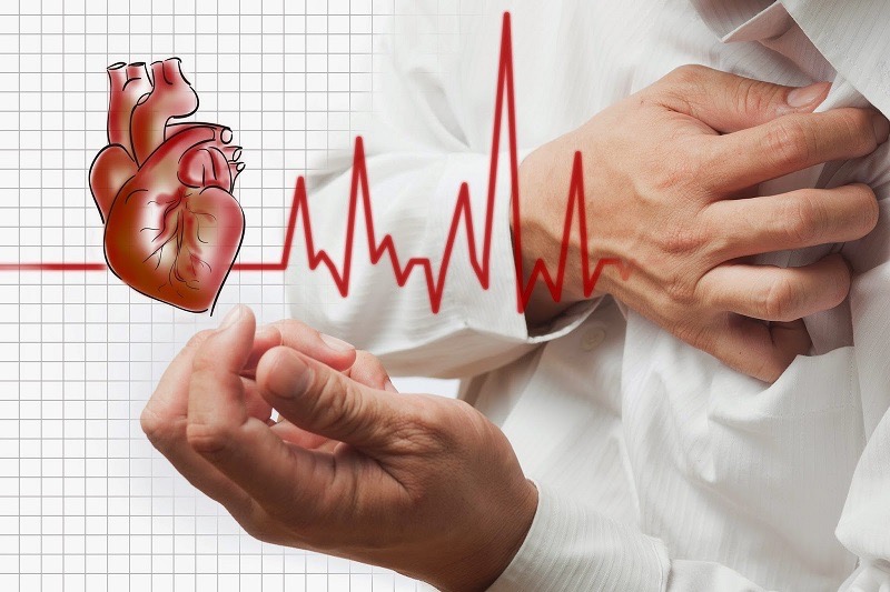 Tìm hiểu về Bệnh Động Mạch Vành và Cách Phòng Ngừa Bệnh Động Mạch Vành