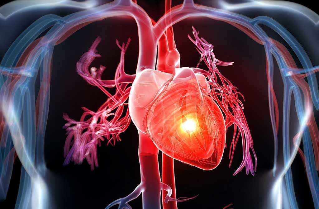 Yếu tố nguy cơ gây bệnh van tim
