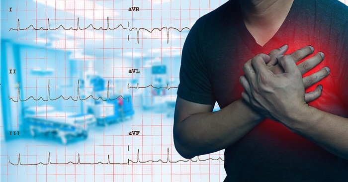 Các biến chứng của rối loạn nhịp tim
