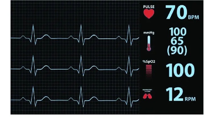 Tần số tim (heart rate) bình thường là bao nhiêu?