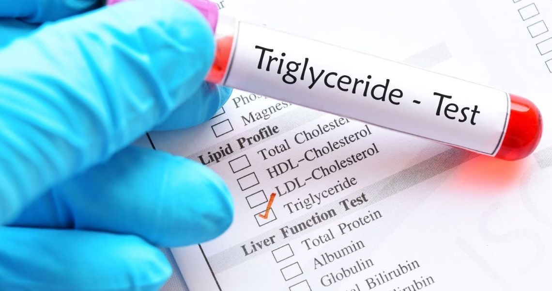 Nguyên nhân gây mức triglyceride cao là gì?