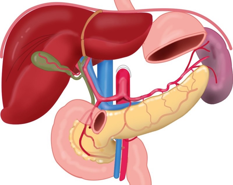 Bệnh phình động mạch: Nguyên nhân, triệu chứng, chẩn đoán và điều trị