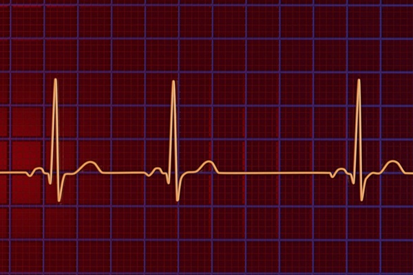 Rối loạn nhịp tim ác tính là gì?