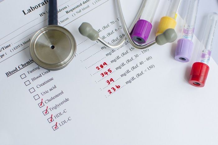 Cholesterol toàn phần là gì? Tại sao cần đo cholesterol toàn phần?