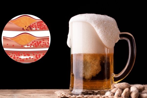 Bia có ảnh hưởng thế nào đến việc kiểm soát cholesterol?
