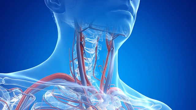 Huyết khối tĩnh mạch cảnh: Triệu chứng và cách điều trị