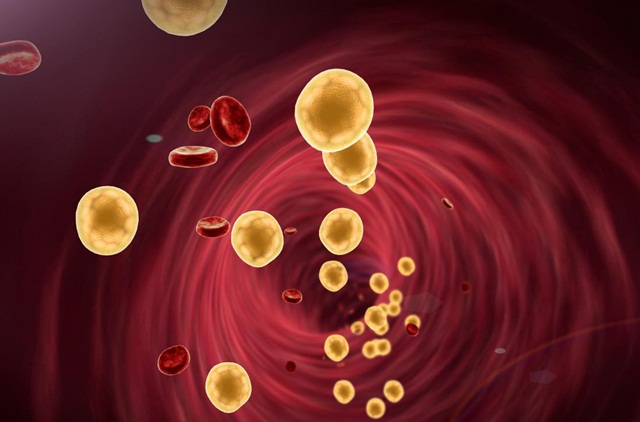 Cholesterol có phải một loại lipid không?