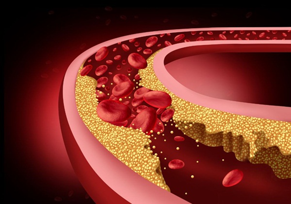 Cholesterol còn lại là gì?