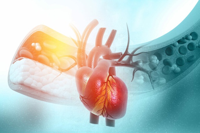 Căng thẳng kéo dài có thể gây tăng cholesterol máu