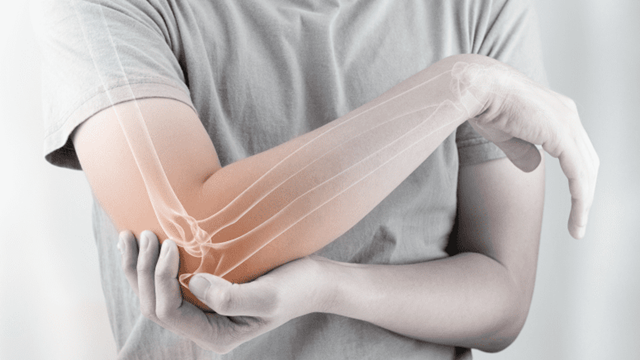 Viêm khớp phản ứng: Triệu chứng, nguyên nhân và điều trị