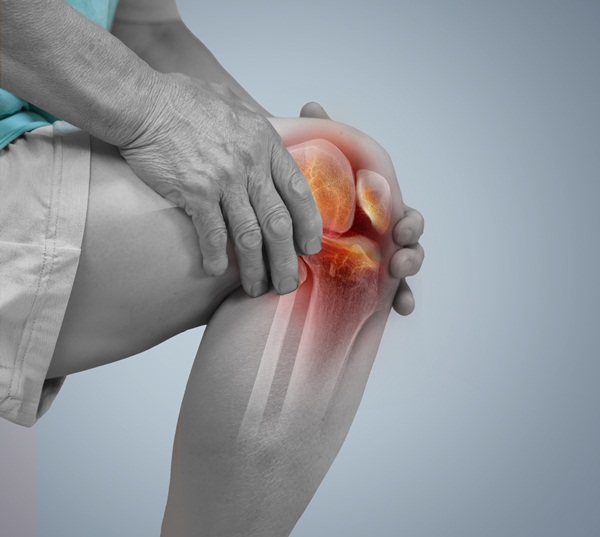 Viêm khớp: Triệu chứng, nguyên nhân và phương pháp điều trị