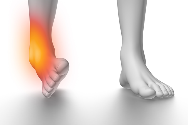 Trật mắt cá chân điều trị bằng cách nào?