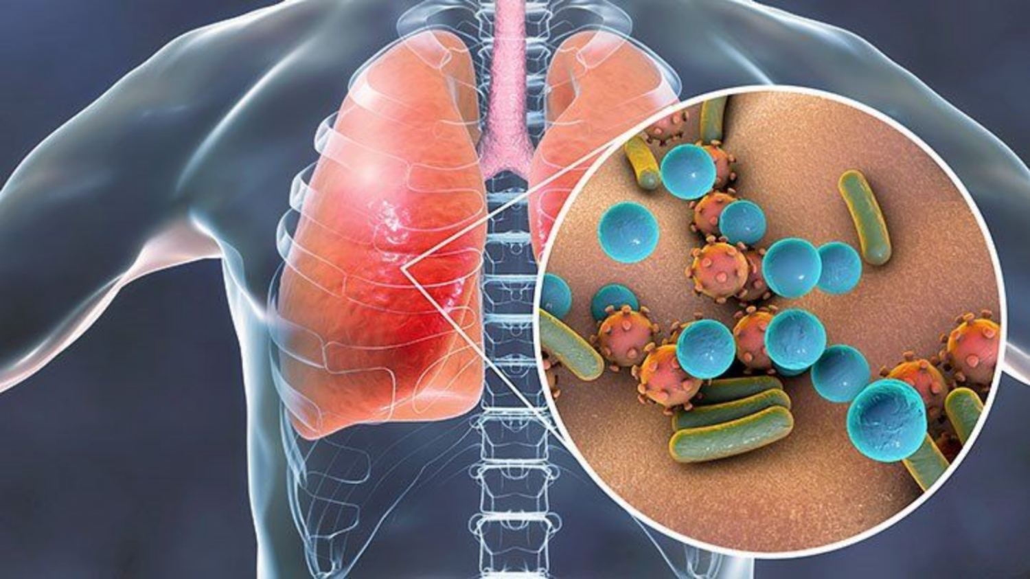 Các biến chứng nguy hiểm nhất của HIV/AIDS
