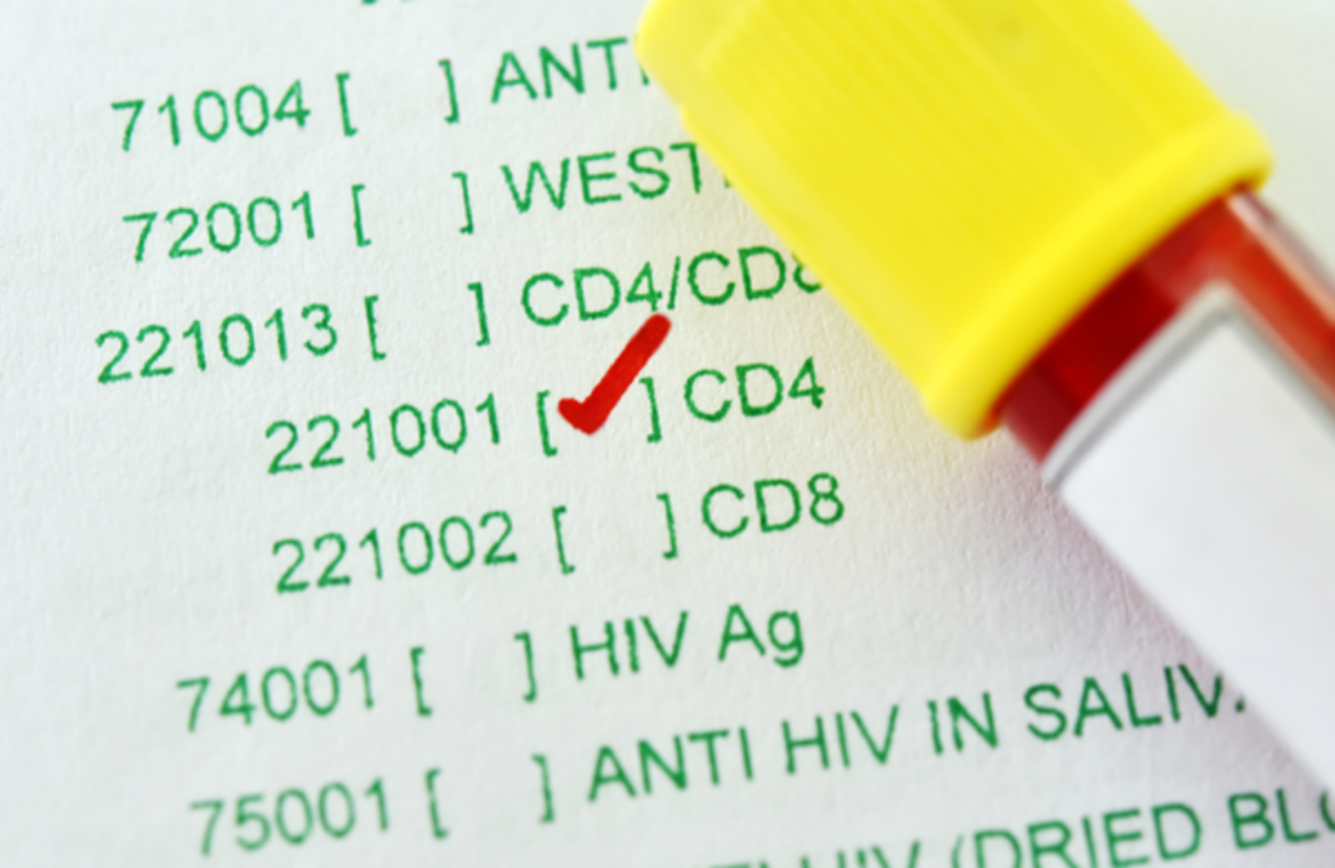 Xét nghiệm đếm tế bào CD4 và đo tải lượng virus