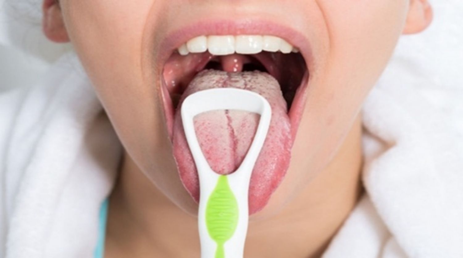 Nhiễm chlamydia ở miệng: Những điều cần biết