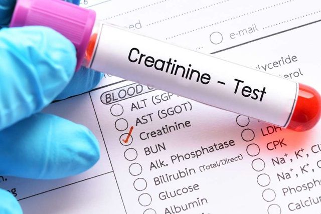Xét nghiệm creatinin máu là gì?
