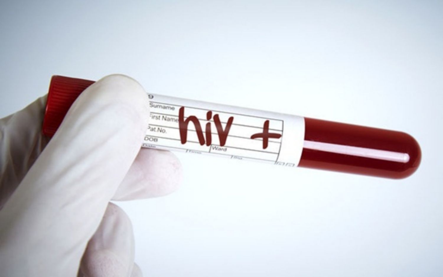 Thời kỳ cửa sổ của HIV là gì?