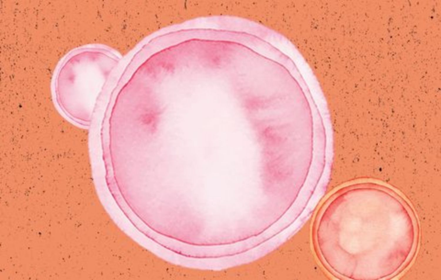 Nhận biết triệu chứng herpes qua dịch tiết sinh dục