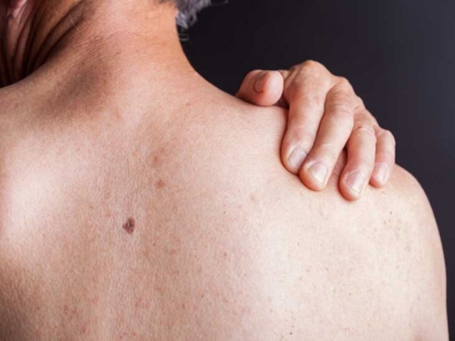 HIV ảnh hưởng thế nào đến cơ thể?