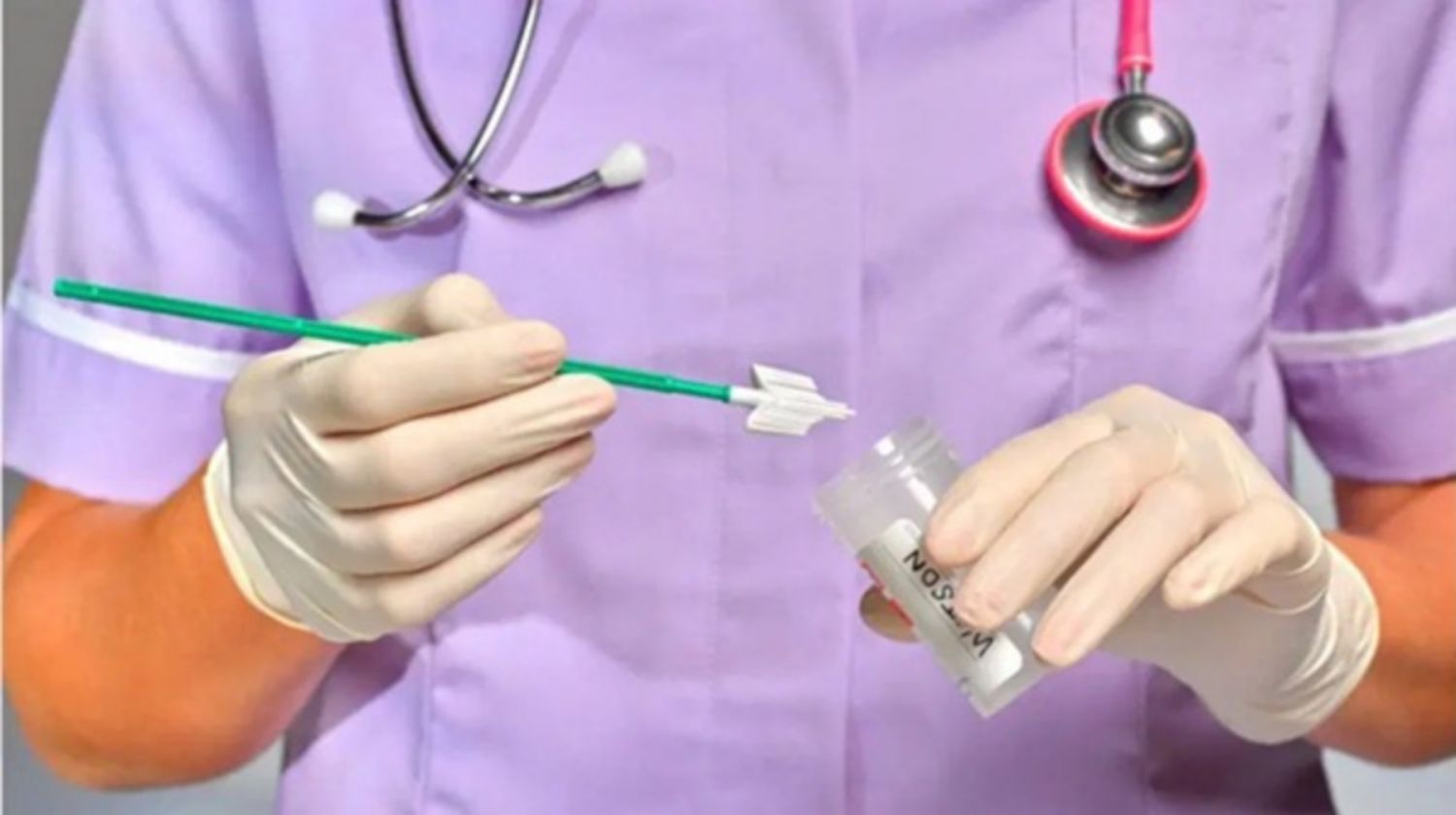 Những điều cần biết về xét nghiệm HPV