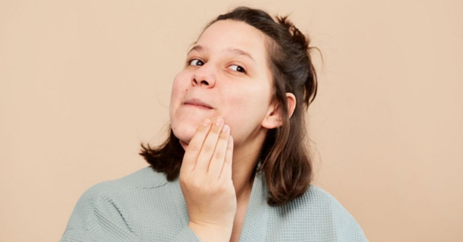 Cách Trị Mụn Trứng Cá Kinh Nguyệt?