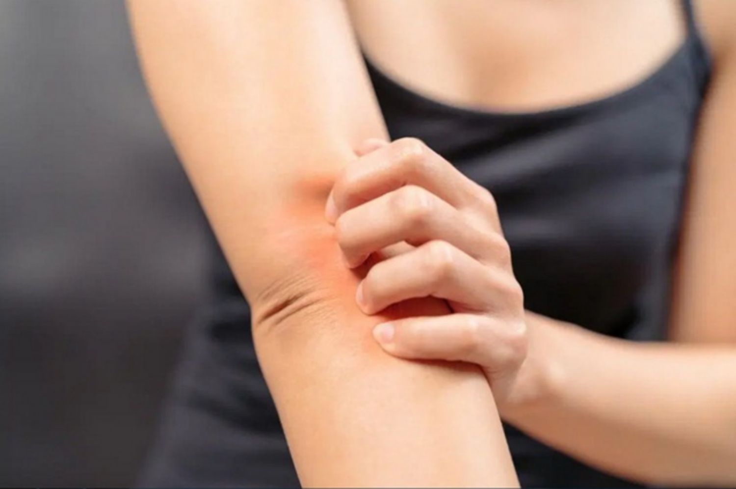 Tại sao lại bị ngứa trong thời kỳ mãn kinh?